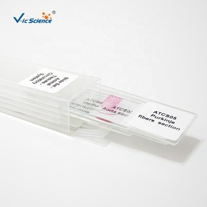 Oferta Especial: Juego de Cinco Portaobjetos Preparados de Punta de Raíz de Cebolla para <span class=keywords><strong>Mitosis</strong></span> - Product Image 2