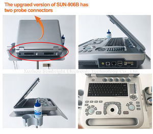 <span class=keywords><strong>Prix</strong></span> de l'appareil d'<span class=keywords><strong>écho</strong></span>graphie numérique complet, <span class=keywords><strong>écho</strong></span>graphie cardiaque, obstétrique, <span class=keywords><strong>Doppler</strong></span> couleur - Product Image 4