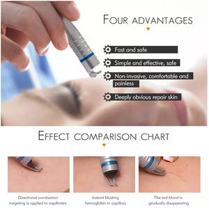 980nm डायोड लेजर मकड़ी नस को हटाने की मशीन भौतिक चिकित्सा संवहनी उपचार डिवाइस - Product Image 4