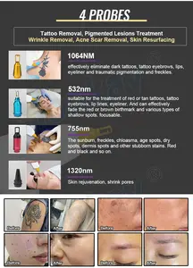 Spa caliente Esteticista rejuvenecimiento de la piel removedor de eliminación de arrugas pecas tatuaje cuerpo facial brazo depilación equipo de salón de belleza