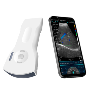 Ecografo Portatile Elettrico SURESULT D3Ultra per Imaging del Seno - Caratterizzazione delle Lesioni, Valutazione degli Impianti e Guida alla Biopsia - Product Image 2