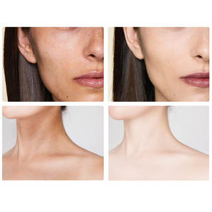 Handmade Whitening Soap Skin Care Deep Cleaning Moisturizing Cleansing Essential Temperate Soap Brighten Skin Kojic Acid Soap - Product Image 4