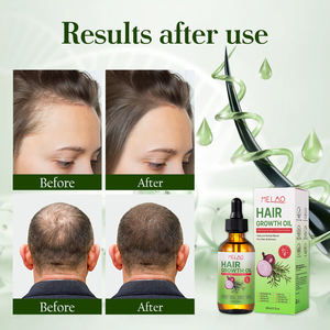 Formule personnalisée, mélange d'herbes naturelles, texture douce, huile de soin, HUILE DE CROISSANCE CAPILLAIRE pour les soins quotidiens - Product Image 3