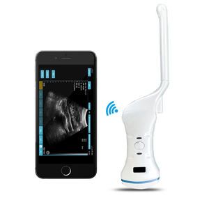 Pemindai Ultrasound nirkabel, alat periksa vagina cembung mikro WIFI cembung - Product Image 3