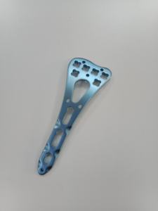 Geasure Titanium Aloi VA piringan pengunci Radius Distal mikro LCP pelat Radius distral sudut variabel - Product Image 4