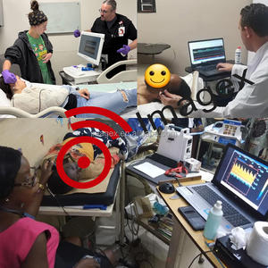 Máquina TCD de onda continua de Neurología Doppler transcraneal para vasos cerebrales y del cuello - Product Image 5