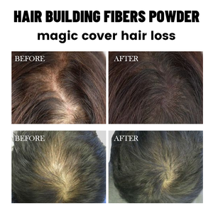 Private Label Hair Loss Treatment 27.5g Hair Building Thickening Fibers Powder <b>Spray</b> Applicator Pump Nozzle Hair Fiber Powder - Product Image 2