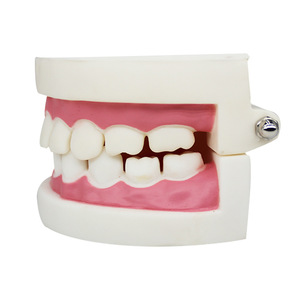 Dental preparation practice model, interdental <b>gap</b> model, tooth preparation model, teaching implant model, denture props - Product Image 3