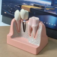 Supplier Grosir Printer 3D Logam Desktop Gigi yang Hemat Biaya Teknologi SLM Operasi Otomatis 110-130 Mahkota/3-5 Jam
