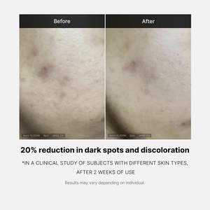 Ampolla Medicube Deep Vita C con 14.5% de Vitamina C, Sérum para Rostro y Cuello, Elimina Imperfecciones - Product Image 5