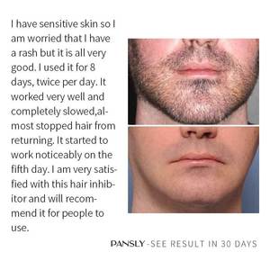 Crema <span class=keywords><strong>de</strong></span> eliminación <span class=keywords><strong>de</strong></span> <span class=keywords><strong>vello</strong></span> púbico para hombres y mujeres, crema <span class=keywords><strong>de</strong></span> Aloe Vera para axila facial y corporal, eliminador <span class=keywords><strong>de</strong></span> <span class=keywords><strong>vello</strong></span> permanente indoloro <span class=keywords><strong>de</strong></span> etiqueta privada - Product Image 5