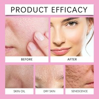 Crème de soin des pores Hoygi, ensemble jour et nuit pour enfants, crème nettoyante en profondeur pour une peau plus raffinée, pores plus lisses et affinés