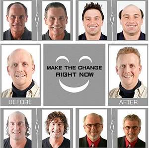 Prótesis Capilar Remy China <span class=keywords><strong>para</strong></span> Hombre, 38mm, Nudo Único, Sin Costuras, Textura Ultrafina Similar al Cuero Cabelludo, Tejida a Mano, 110% de Densidad, Ondas Naturales - Product Image 4