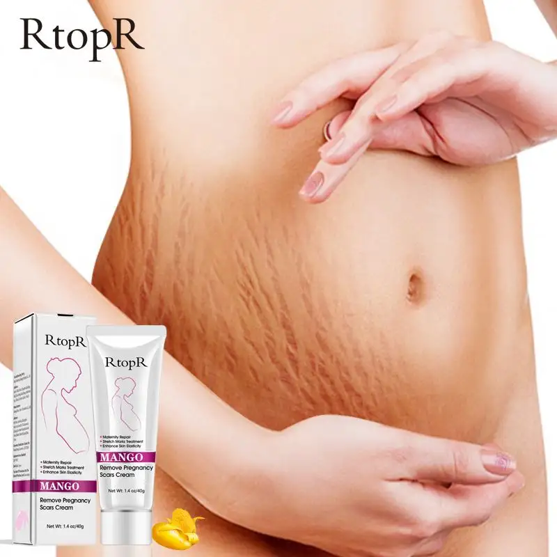 Discount new Wholesale Natural Mild Remove Acne Mark For Pregnancy Repair Abdomen scar Stretch Remover Cream