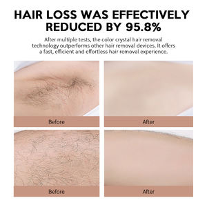 Depiladora de Cristal Lavable y Reutilizable al por Mayor, Eliminador de Vello Indoloro para Piernas y Brazos, Depilación Física para Uso Doméstico - Product Image 4
