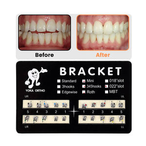 Kosteneffectieve Mim Orthodontische Beugels <span class=keywords><strong>Mbt</strong></span>/Roth Mini Standaard Metalen <span class=keywords><strong>Ortho</strong></span> Apparaten - Product Image 4