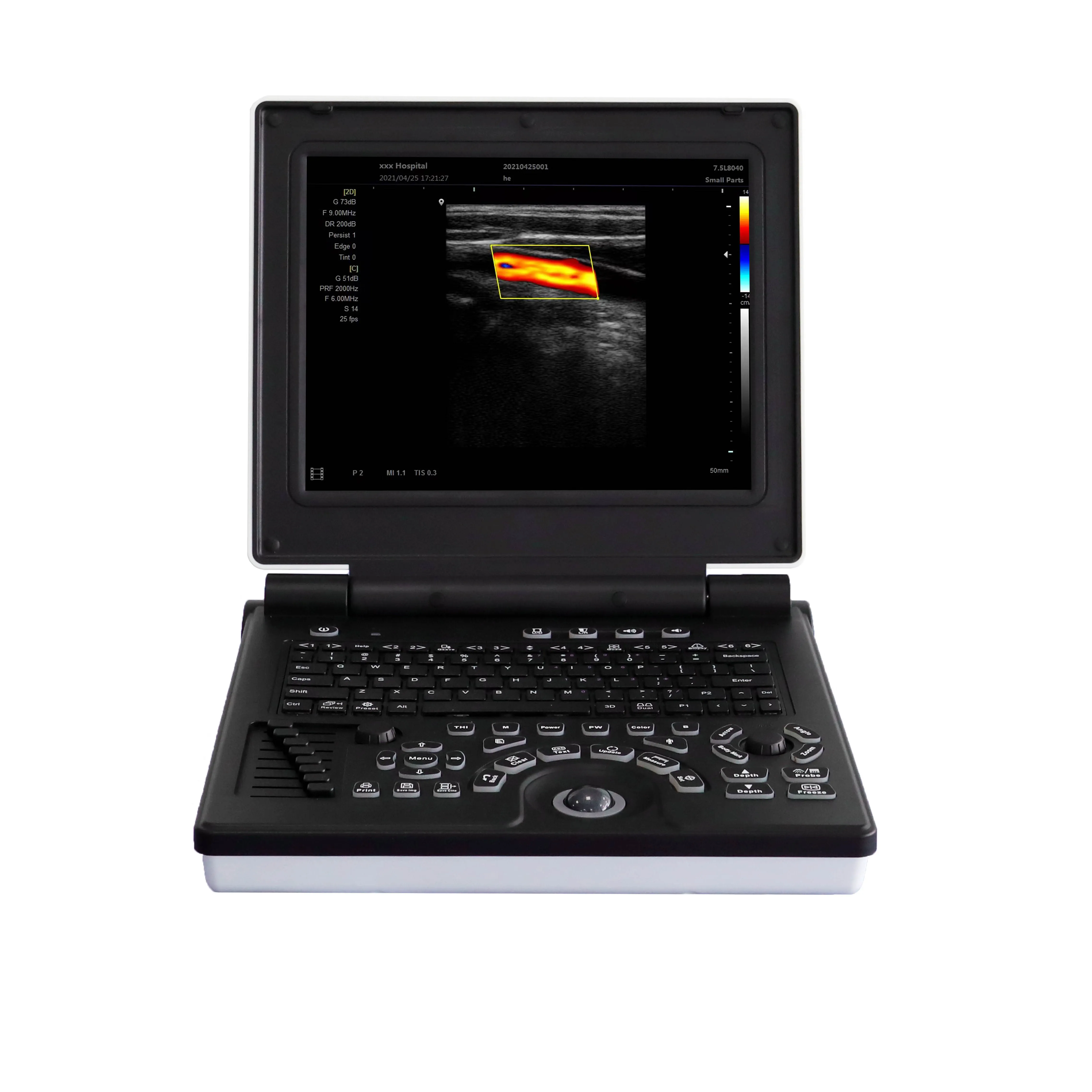 Mesin Ultrasound hitam dan putih medis dengan sistem multi-bahasa Windows 7