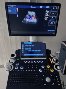 Kualitas tinggi jenis troli perangkat medis <span class=keywords><strong>128</strong></span> elemen pemeriksaan 19 tampilan LED warna <span class=keywords><strong>Ultrasound</strong></span> - Product Image 6