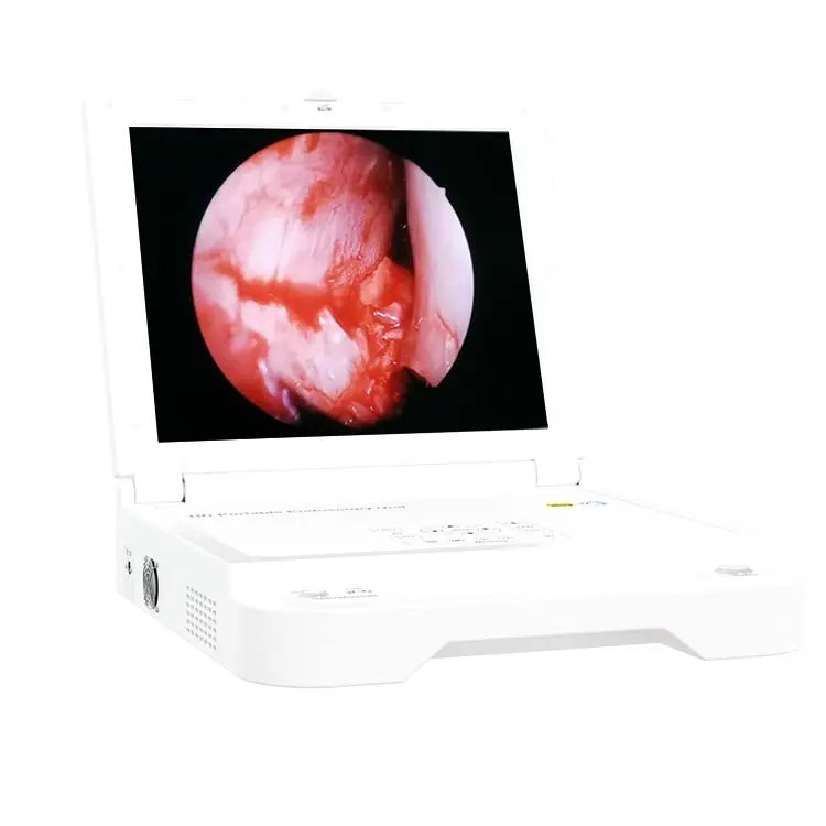 Sistema di telecamere endoscopiche rigide portatili brank medical