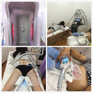 Meilleur prix, <span class=keywords><strong>machine</strong></span> de <span class=keywords><strong>cryolipolyse</strong></span> pour le corps, refroidissement à 360°, équipement de sculpture corporelle pour la perte de poids - Product Image 6