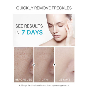 ครีมบำรุงผิวหน้าเพื่อซ่อมแซมผิวด้วยกลิ่นกุหลาบครีมดำจุดด่างดำ fcj - Product Image 5