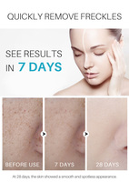 Sérum Correcteur Anti-Taches et Anti-Imperfections Personnalisé OEM à Base de Plantes Naturelles, Crème Visage Réparatrice et Blanchissante pour Taches de Rousseur, Boutons et Taches Brunes