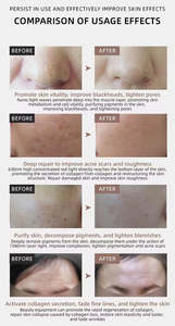 Masseur facial à lumière rouge avec masque LED 7 couleurs <span class=keywords><strong>pour</strong></span> la réduction <span class=keywords><strong>de</strong></span> l'acné et la prévention des rides, à brancher - Product Image 6