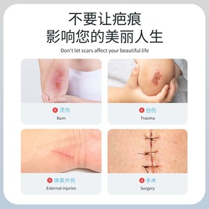 Gel cicatrisant médical en silicone Compvov 15g pour les cicatrices chirurgicales, de césarienne et de brûlures, utilisation corporelle, facilement absorbable - Product Image 3