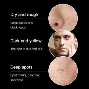 VENZEN Marque privée Vente en gros Soins <span class=keywords><strong>de</strong></span> la peau <span class=keywords><strong>Beauté</strong></span> <span class=keywords><strong>Produits</strong></span> <span class=keywords><strong>de</strong></span> soins <span class=keywords><strong>de</strong></span> la peau pour hommes Élimination <span class=keywords><strong>de</strong></span> l'acné Exfoliant Ensemble <span class=keywords><strong>de</strong></span> soins <span class=keywords><strong>de</strong></span> la peau coréens naturels - Product Image 4