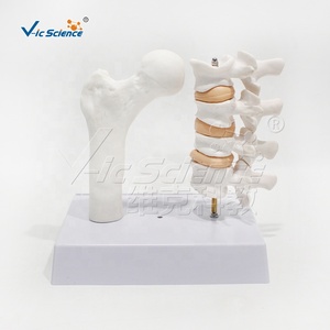Modelo de Hueso de Osteoporosis, Modelo Anatómico de Esqueleto Humano en PVC para Escuelas - Vic <span class=keywords><strong>Science</strong></span> VIC-V45 - Product Image 3