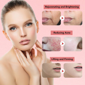 2026 Photon Skin Revitalizer, appareil portable pour le soin des yeux, raffermissant, liftant et nourrissant - Product Image 2