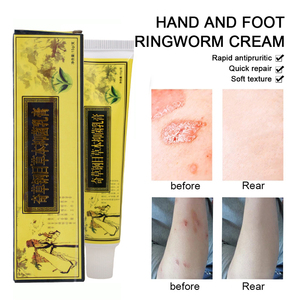 Crème naturelle aux herbes chinoises 15g pour le psoriasis, l'eczéma, les démangeaisons cutanées, les infections fongiques, soin de la peau, pommade - Product Image 2