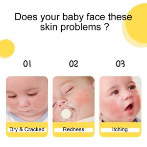 Crème hydratante éclaircissante à la calendula biologique vegan en marque propre, meilleure crème hydratante, crème éclaircissante pour le <span class=keywords><strong>visage</strong></span> de bébé - Product Image 2