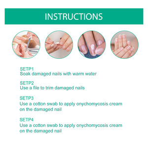 Crema de Suero Hongo para Uñas, Gel Hongo para los Pies, Onicomicosis, Paroniquia, Pomada PARA EL Cuidado DE LA Salud - Product Image 3