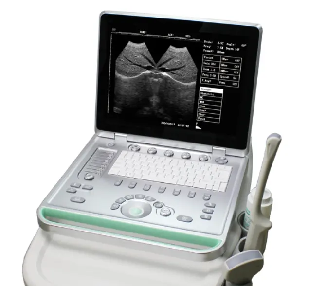 MSLPU34 Cardiale Draagbare Ultrasound Machine Prijs Medische Echocardiografie Ecografo Usd Echo Machine