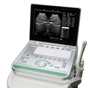 Portable Ultrasound Machine, Medical Echocardiography
