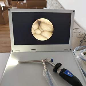 Conjunto de cámara de endoscopia <span class=keywords><strong>integrada</strong></span> médica 4 en 1 para Urología/laparoscopia - Product Image 1