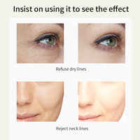 Moika Nouveau Style Éclaircissant Rides Contour des Yeux Sérum Combleur Anti-Âge Lifting et Rajeunissement de la Peau