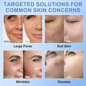 OEM Kollagen Gesichtsmaske Feuchtigkeitsspendende Reparatur <span class=keywords><strong>Anti</strong></span>-Aging Kollagen Gesichtspflege Tuchmaske Hydratisierende Nachtmaske für das Gesicht - Product Image 6