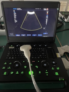Ecógrafo Médico Portátil al Mejor <span class=keywords><strong>Precio</strong></span>, Fabricante Directo <span class=keywords><strong>de</strong></span> Ecógrafos Portátiles - Product Image 5