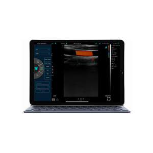 WIFI genggam Ultrasound Mobile Probe KONTED <span class=keywords><strong>Pocket</strong></span> Ultrasound untuk PICC & darurat - Product Image 2