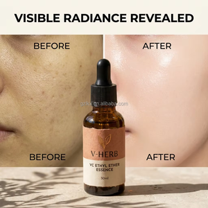 Suero de Glutatión con Vitamina C Etilada Vietnamita para Terapeutas de Spa, Hialuronato de Sodio que Hidrata, Aumenta el Colágeno y Combate el Envejecimiento - Product Image 3
