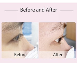 <span class=keywords><strong>Kit</strong></span> de Lifting de <span class=keywords><strong>Pestañas</strong></span> y Cejas DIY, los Más Vendidos al por Mayor, Pegamento <span class=keywords><strong>para</strong></span> Lifting de <span class=keywords><strong>Pestañas</strong></span>, <span class=keywords><strong>Kit</strong></span> de Lifting de <span class=keywords><strong>Pestañas</strong></span> de Marca Privada - Product Image 6