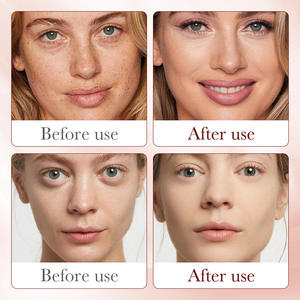 เซรั่มบำรุงผิวหน้า SADOER ดราก้อนส์ บลัด ดรายเนส ช่วยเติมความชุ่มชื้น กระชับผิว ลดเลือนริ้วรอย เรียบเนียน - Product Image 4