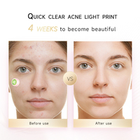 Offre Spéciale de beauté Mini Patch électrique pour bouton d'acné Patch de couverture d'acné Patch hydrocolloïde