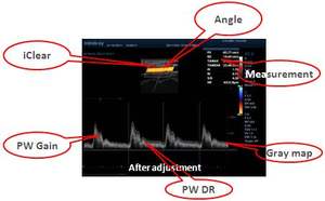 Máquina ultrasónica veterinaria profesional <span class=keywords><strong>Mindray</strong></span>, sistema de ultrasonido de diagnóstico veterinario a prueba de agua - Product Image 5