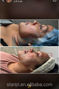 פופולרי 980nm endolaser rf simming butt הרמת משקל אובדן גוף גוף גוף ממריץ הצמד הביקיני - Product Image 3