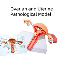 Modèle scientifique médical des lésions pathologiques utérines et ovariennes