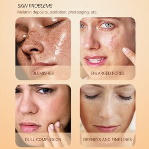 Suero de Cúrcuma Orgánico de 30 ml para el Cuidado de la Piel del Rostro, Aclara la Piel de Forma Efectiva, Venta al por Mayor de Fábrica China - Product Image 5