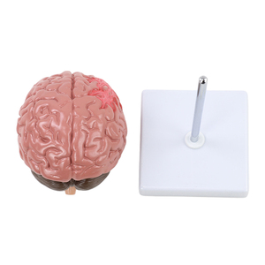 Modelo de Cerebro Humano con <span class=keywords><strong>Derrame</strong></span> Cerebral - Modelo Anatómico de Enfermedad Cerebral Patológica - Hemorragia Cerebral - Lesión Cerebral - Product Image 5